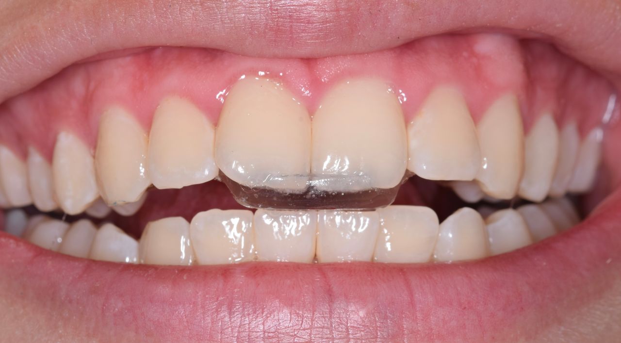 Adair Natanael Alvarez Castañeda-16