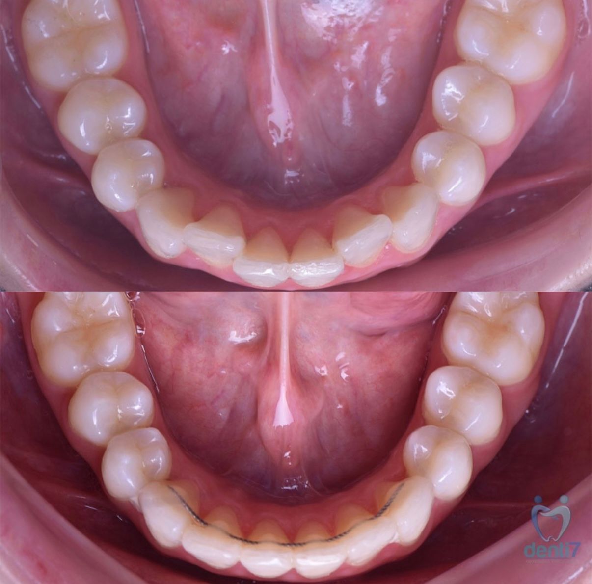 Irving Quezada Lara-15