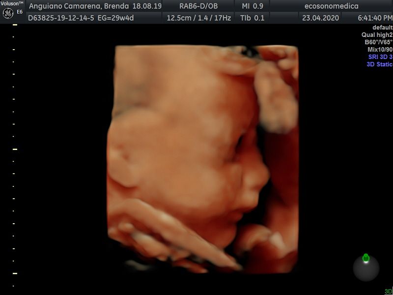 Héctor Bernardo Acevedo Manrique-0