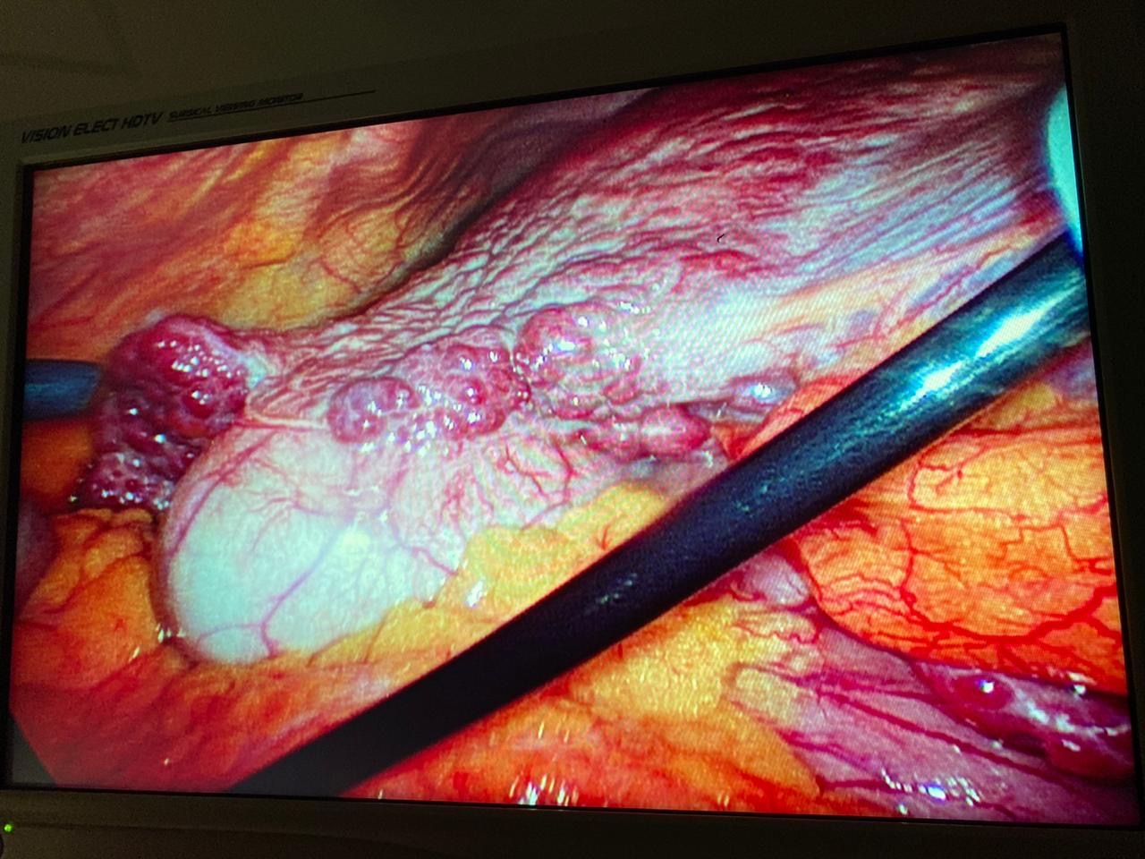 Ismael Gonzalez Torres-4