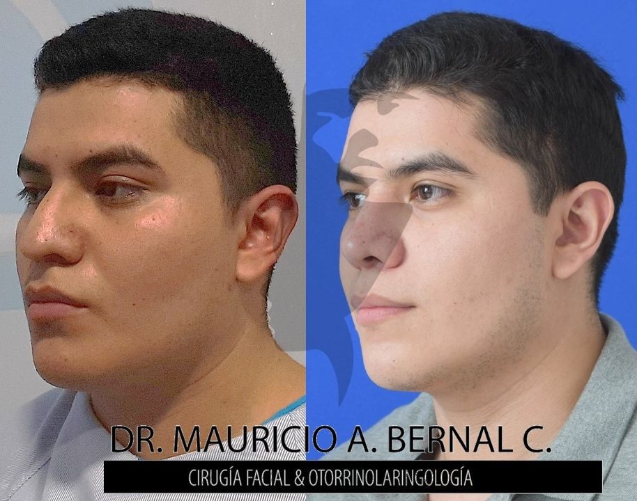 Mauricio Alejandro Bernal Carreon-24