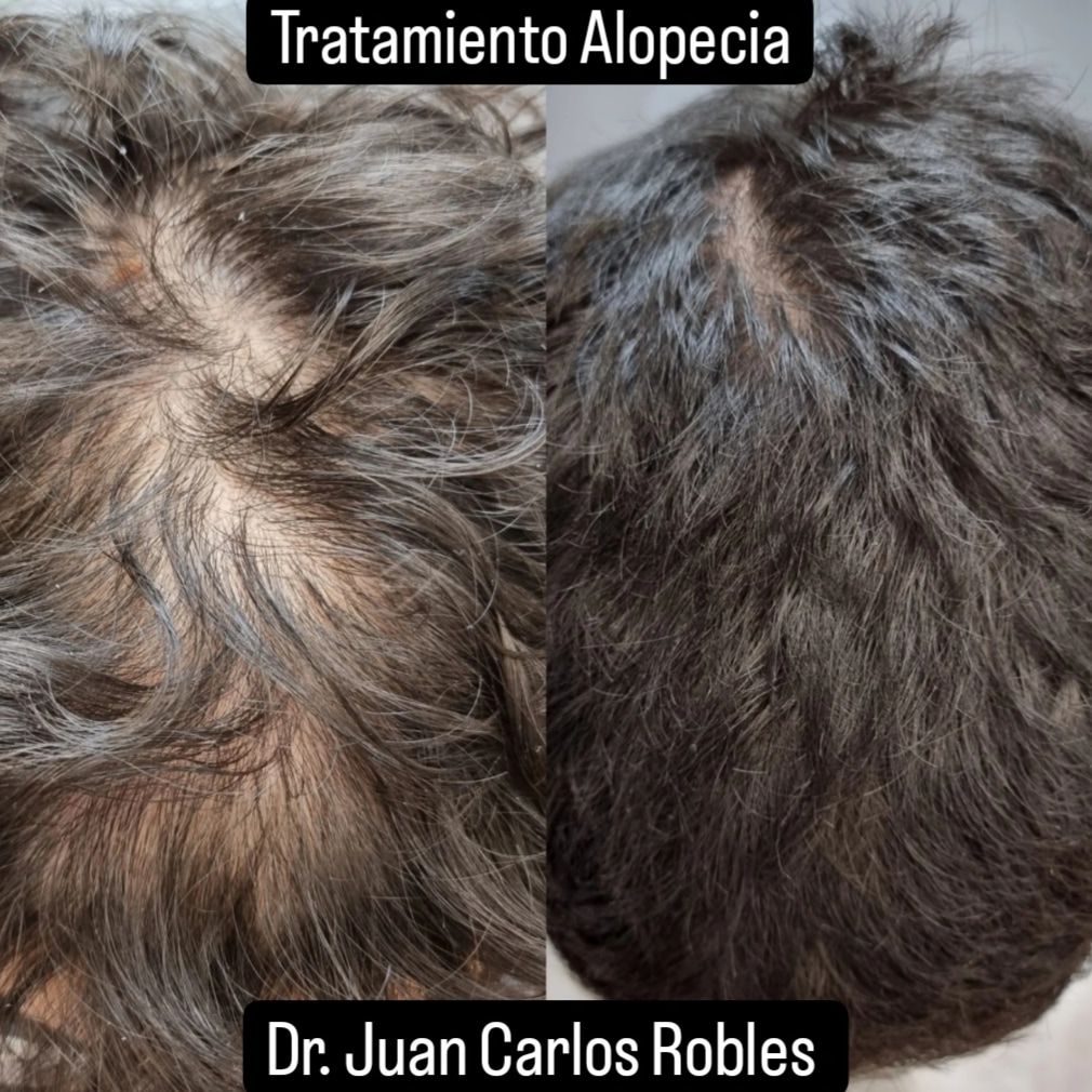 Juan Carlos Robles Méndez-17