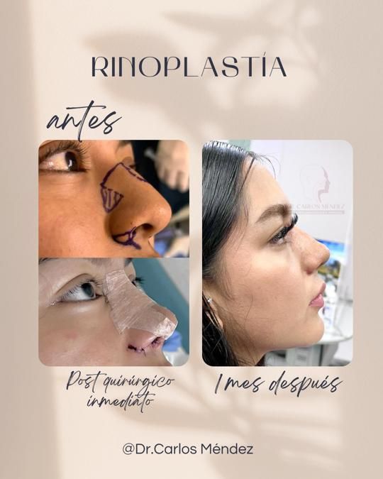 Juan Carlos Mendez Gutierrez-11