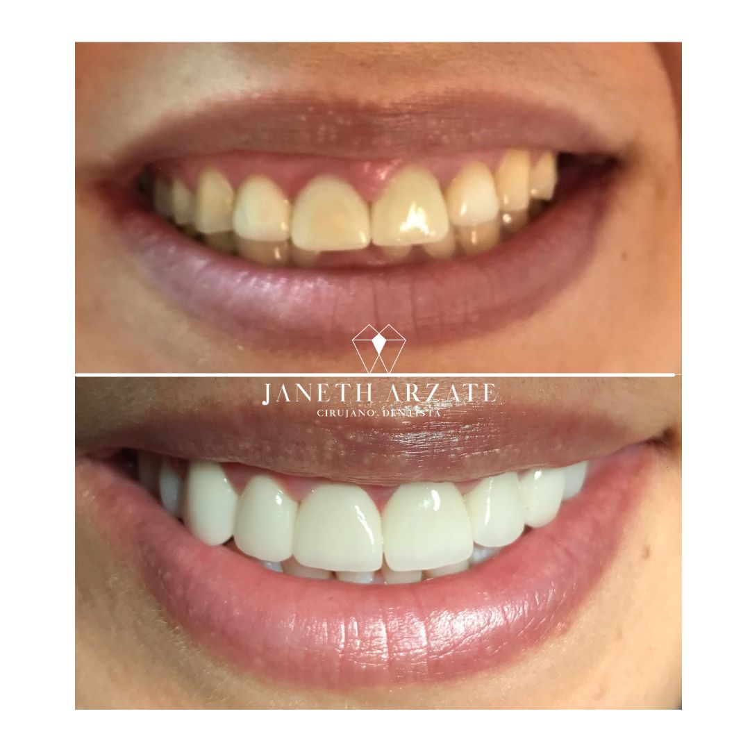 Janeth Arzate Banda-10