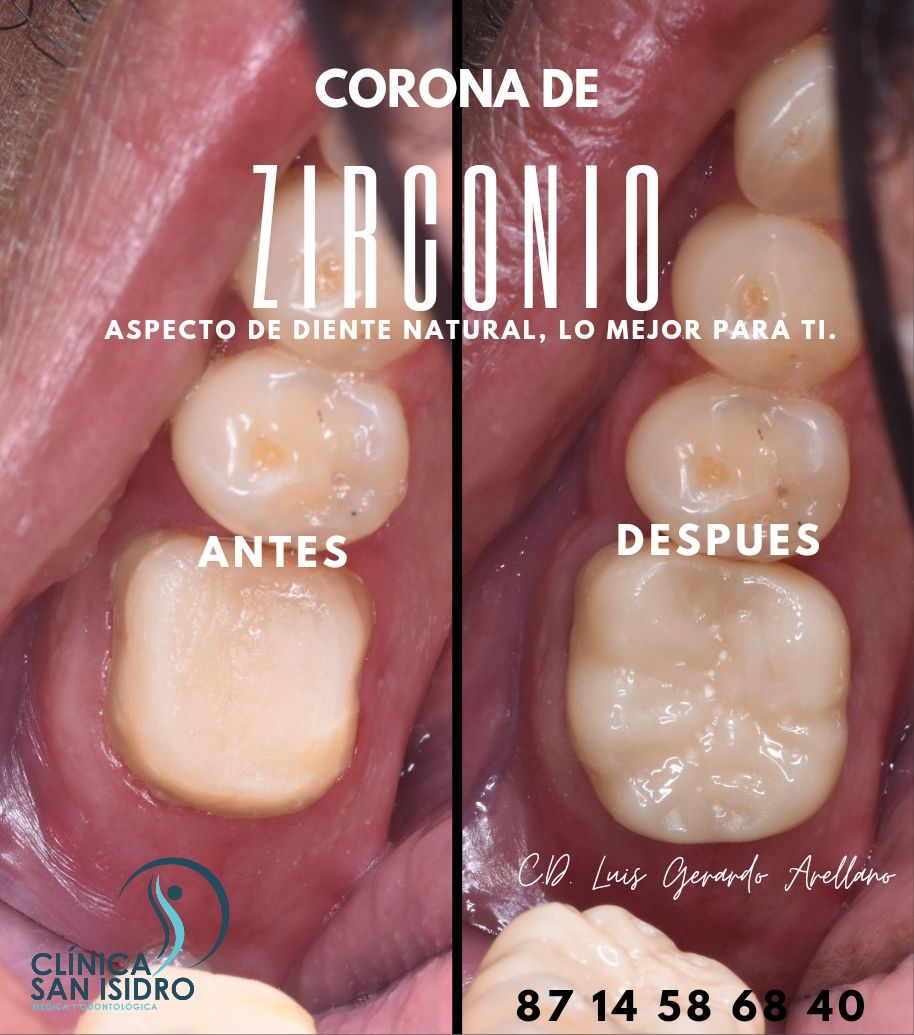 Luis Arellano De León-11