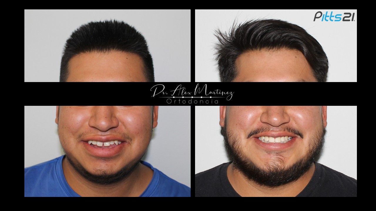 Alejandro Martínez Hernández-14