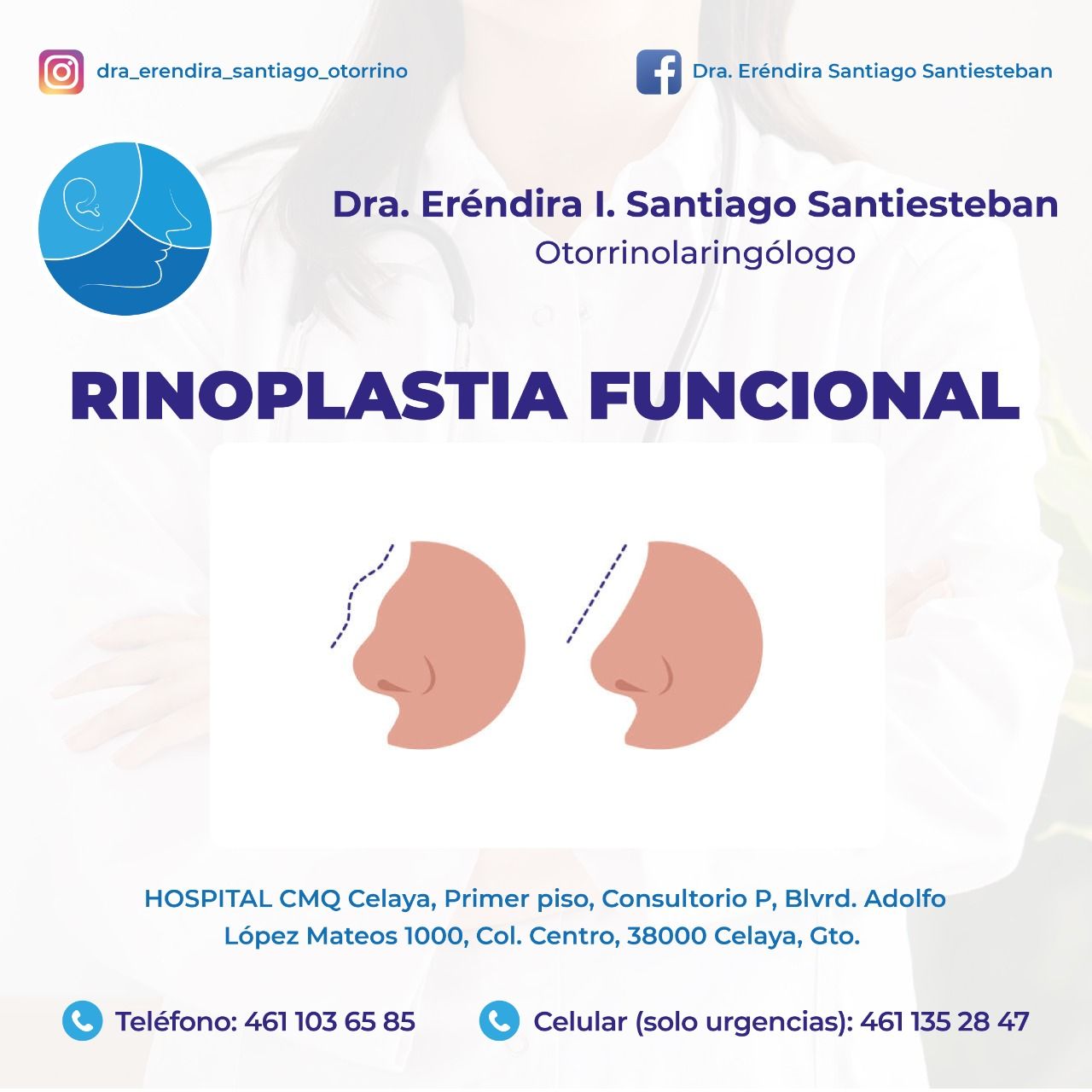 Erendira Santiago Santiesteban-7