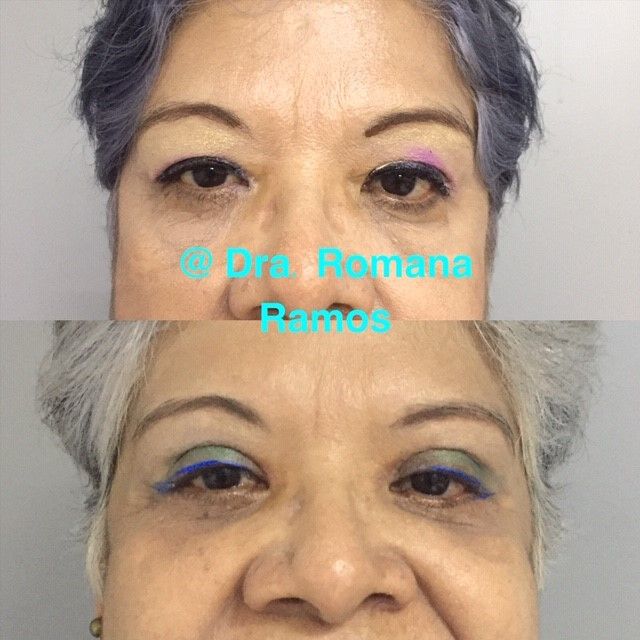 Romana Ramos Cárdenas-24