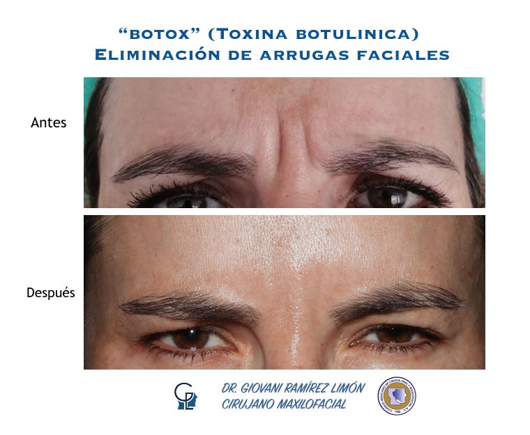 Giovani Ramírez Limón-47