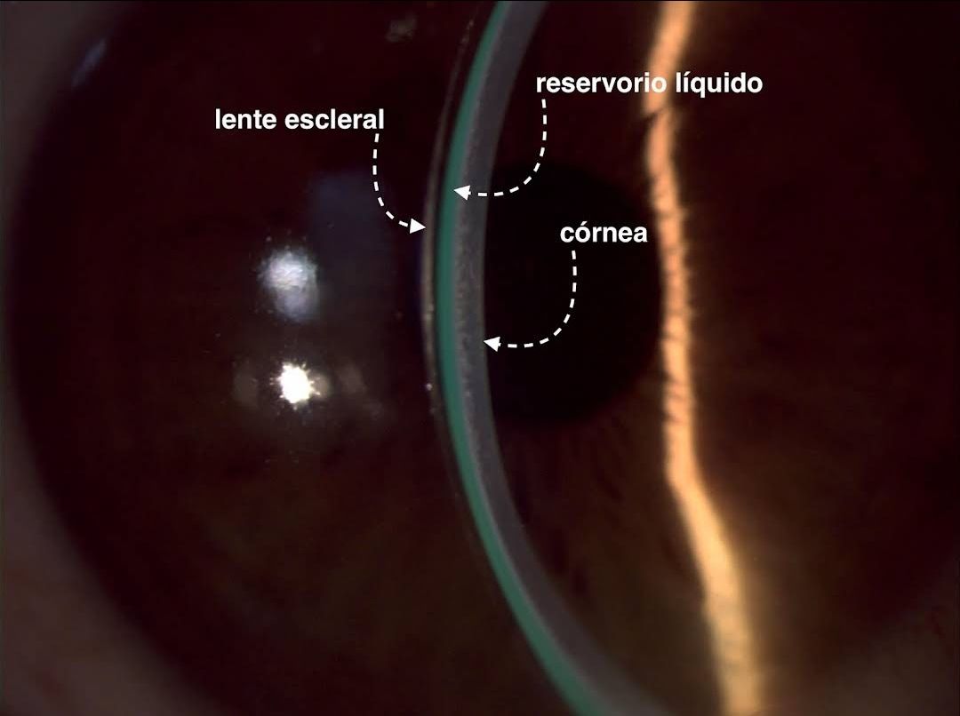 Emma Cedillo García-10