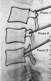 Rafael Maciel Morfin-7