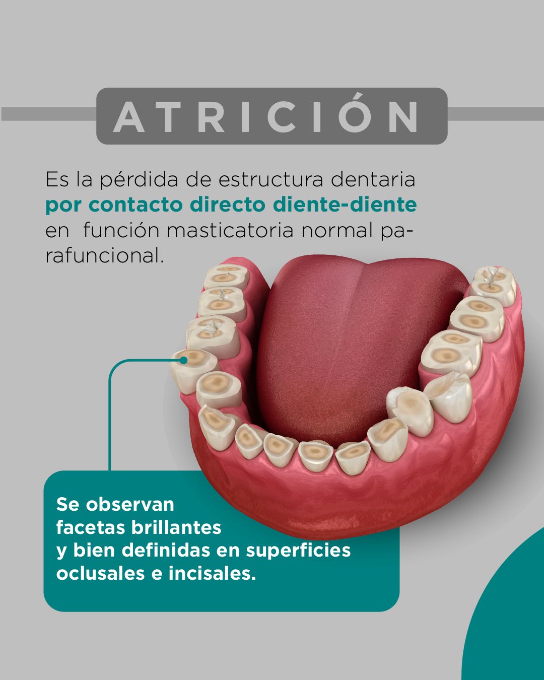 Diana De La Torre Priego-9