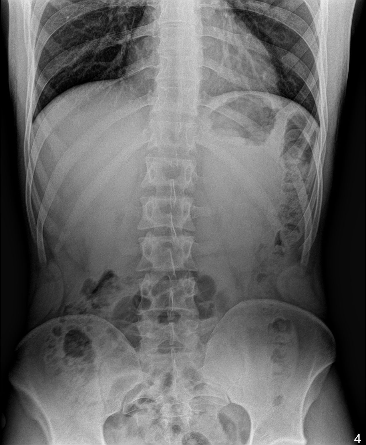 Samuel Garza Pacheco -4