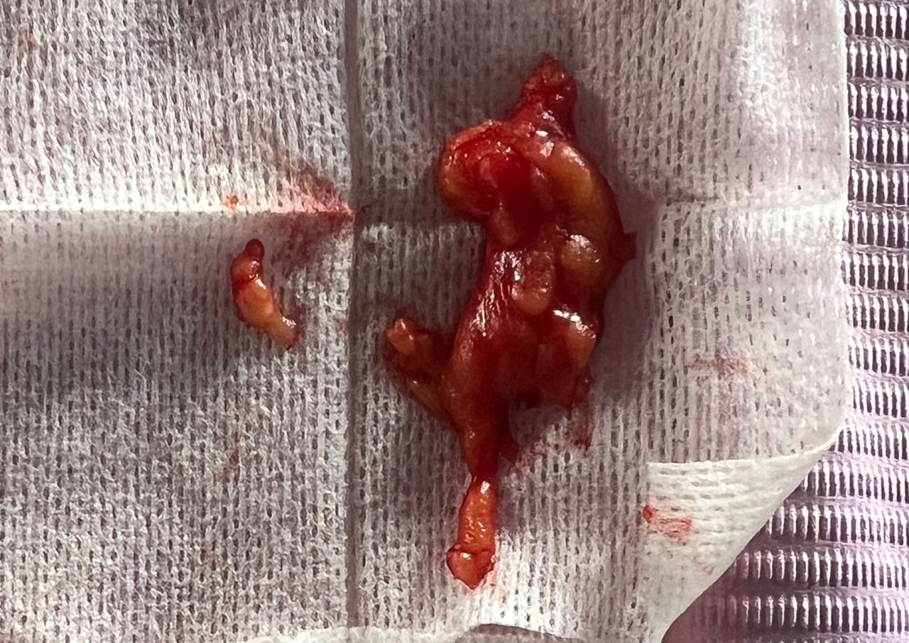 Jair Contreras García-2