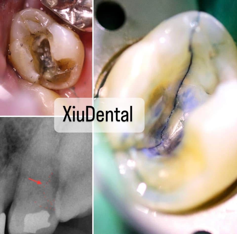 Xiuhnel Solorio Cuevas-4