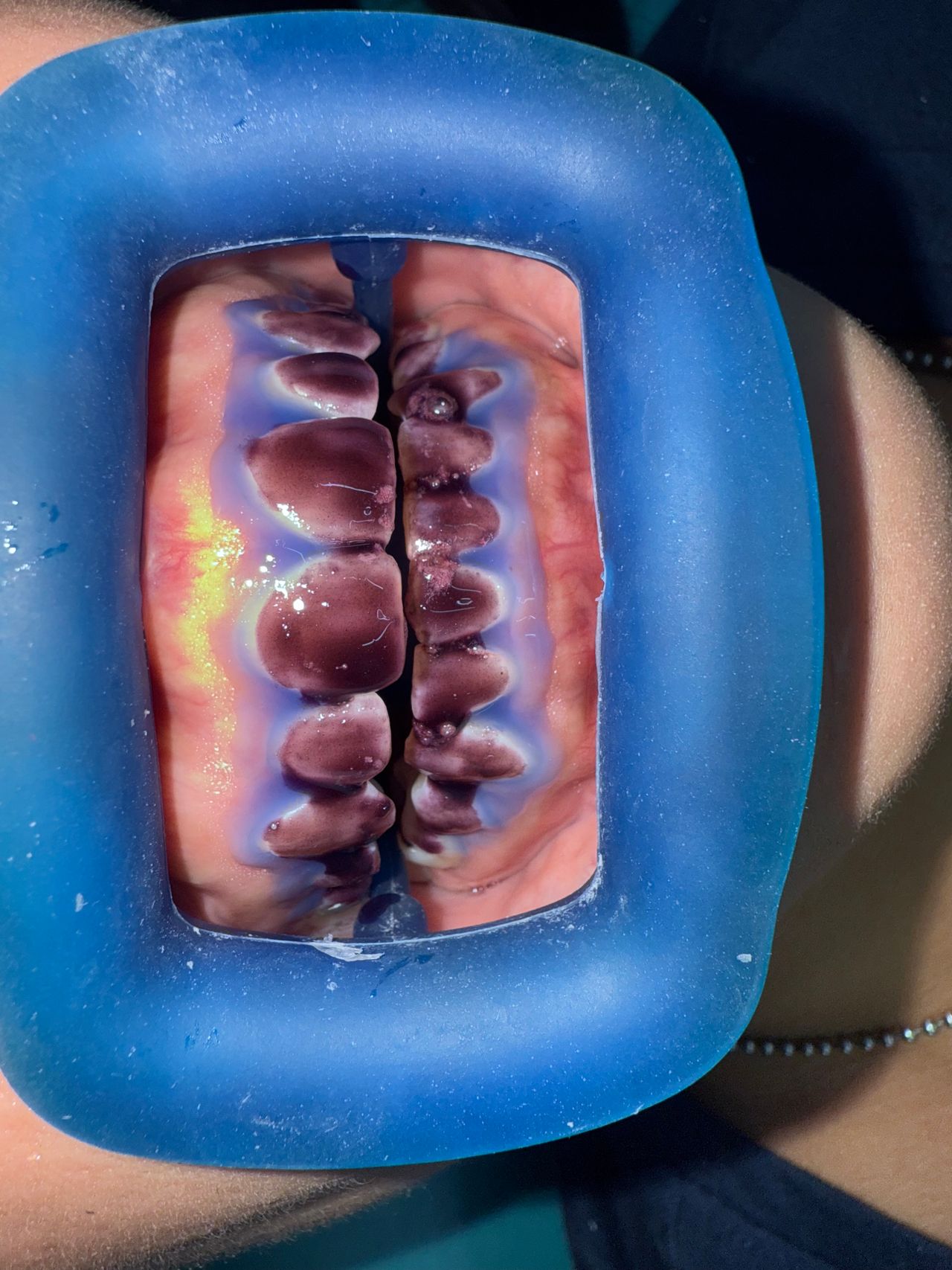 Jair Contreras García-55