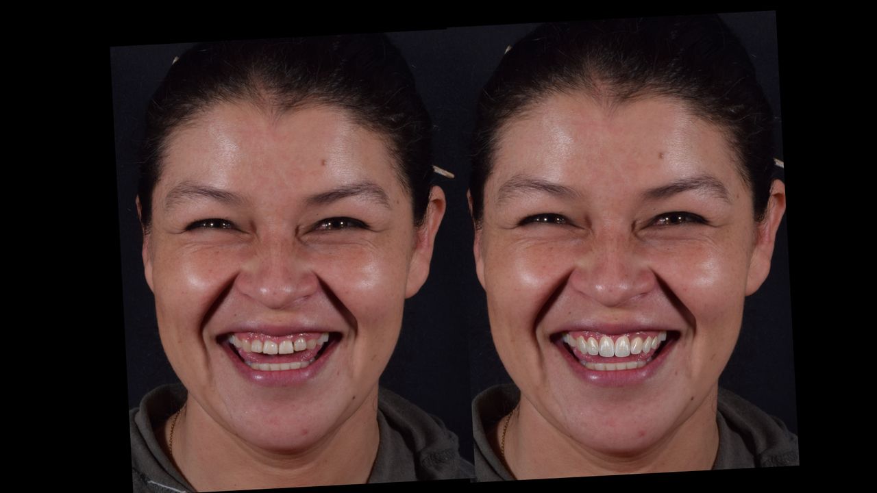 Adair Natanael Alvarez Castañeda-19