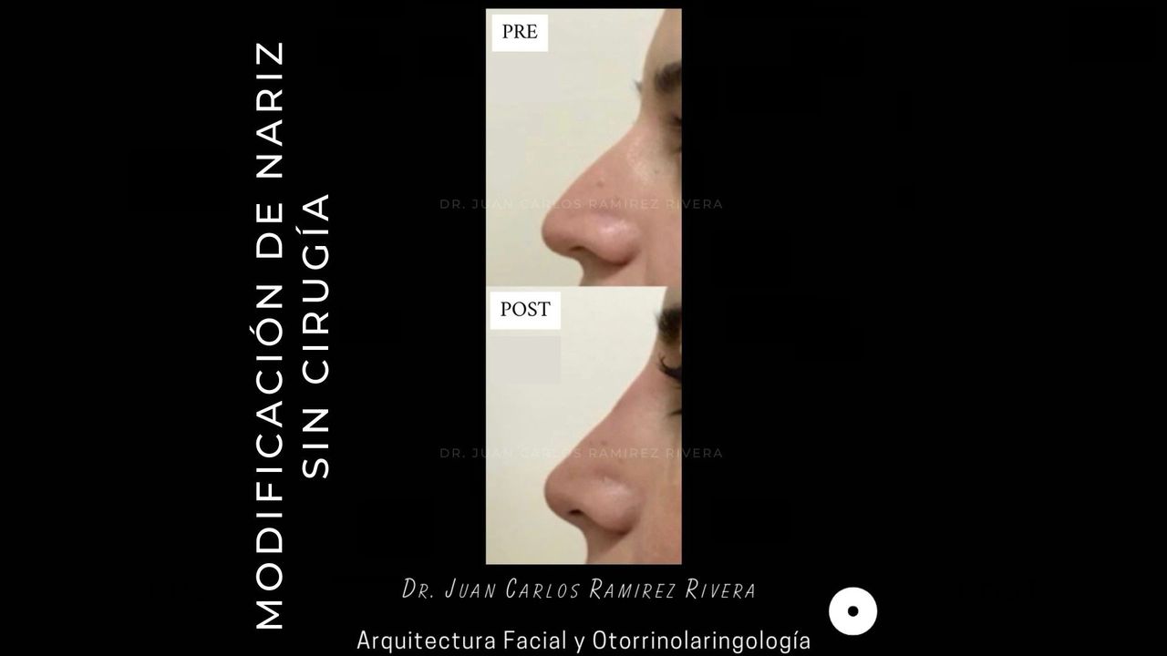 Juan Carlos Ramirez Rivera-11