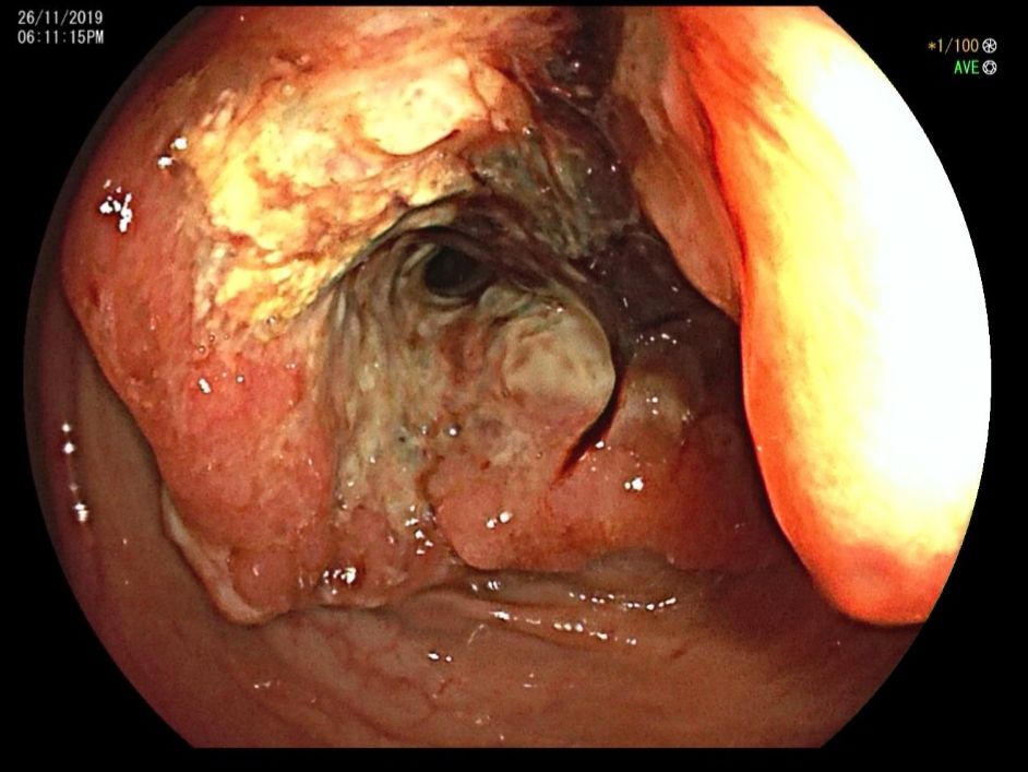 Alejandro Arreola Cruz-10