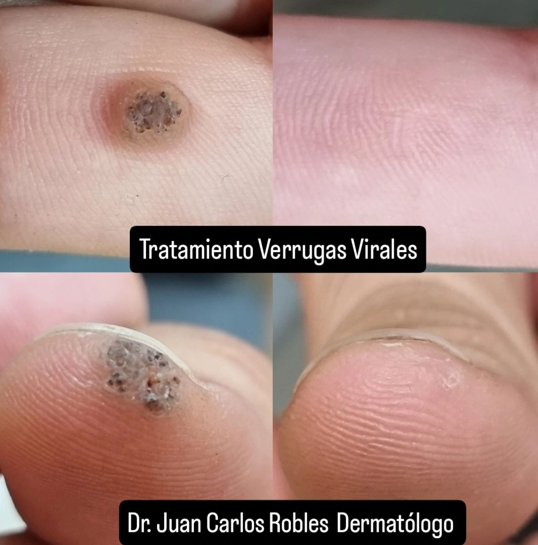 Juan Carlos Robles Méndez-26