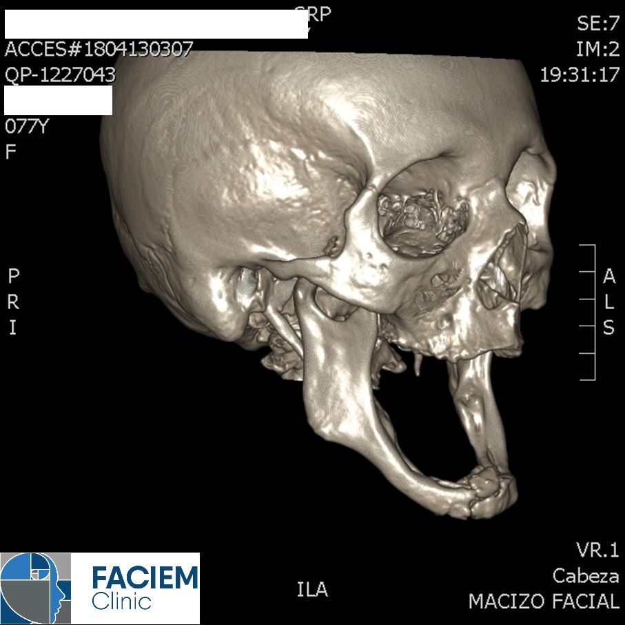 Arlen Colín Ordaz-49