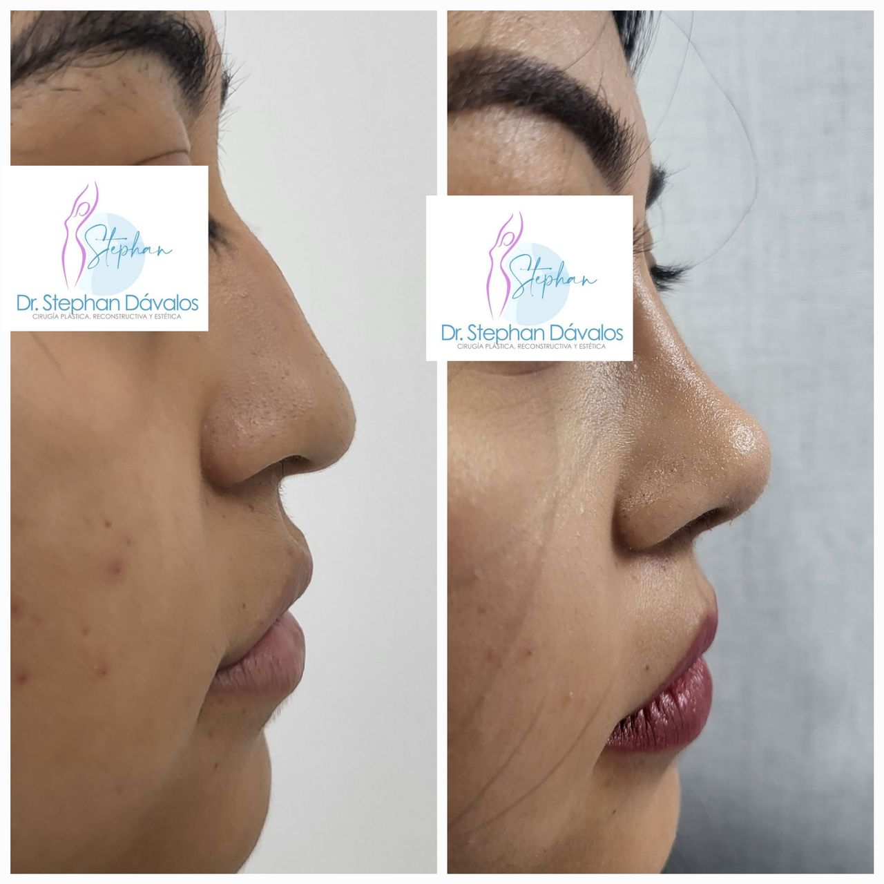 Stephan Dávalos Barrios-12