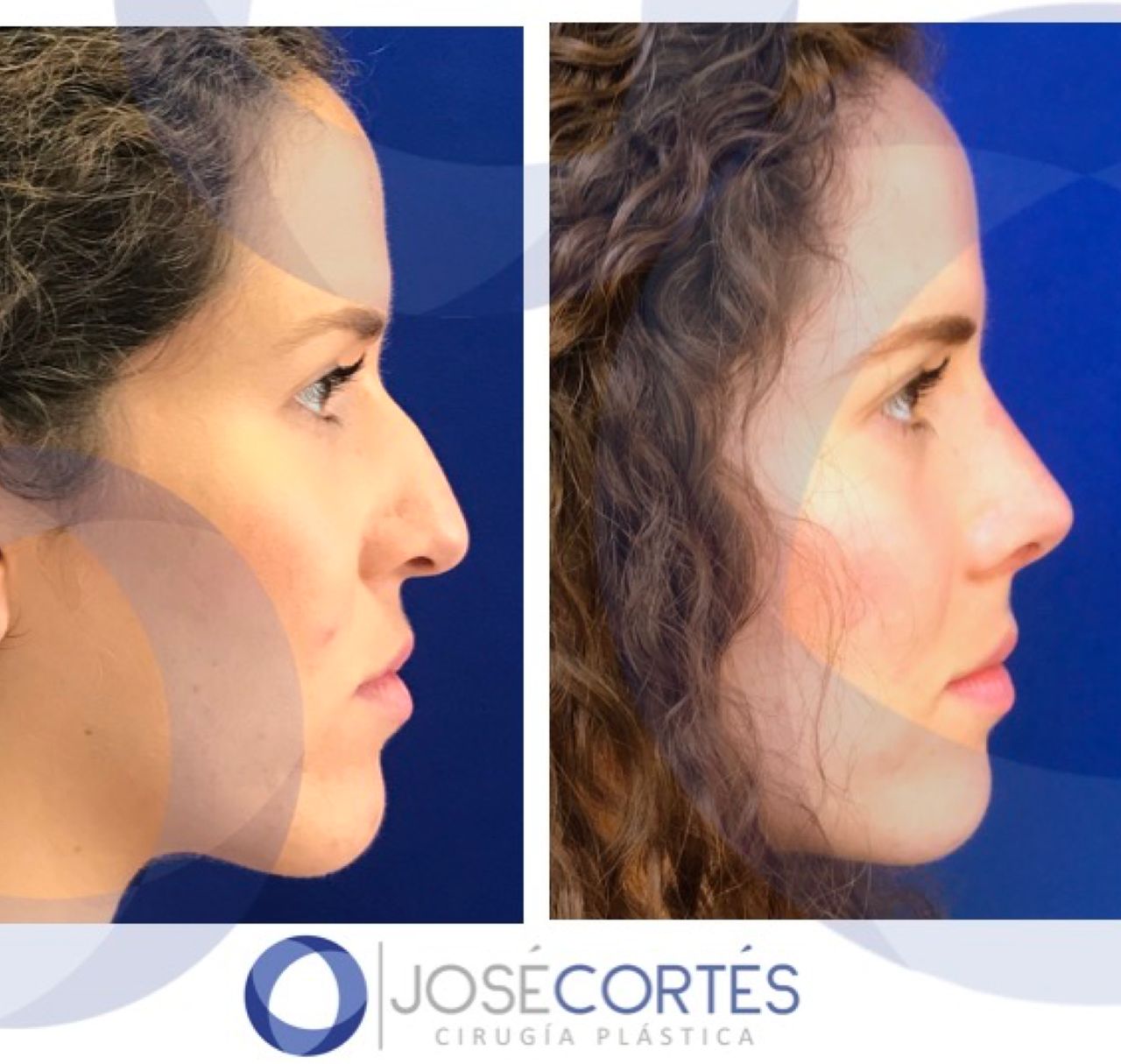 José Cortés Arreguin-9