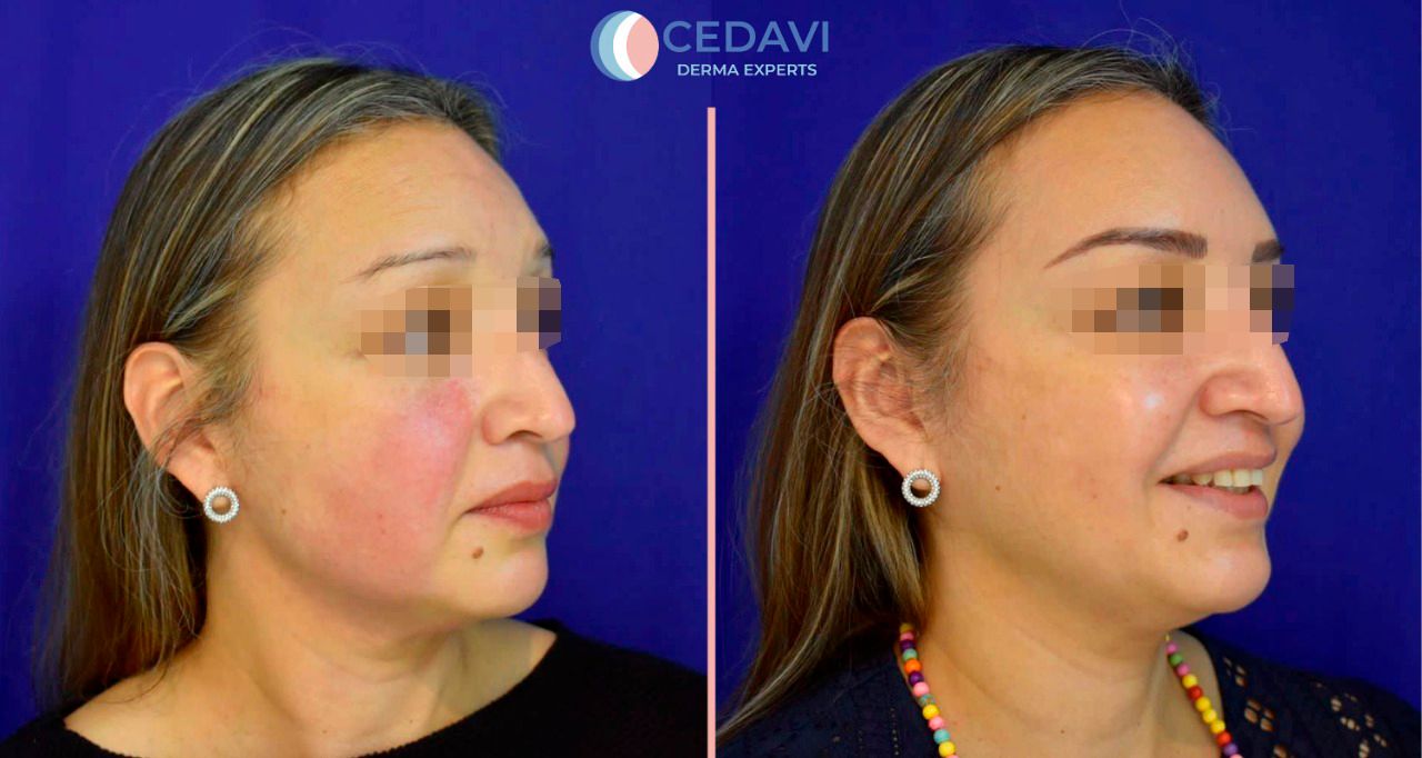 César Daniel Villarreal Villarreal-14