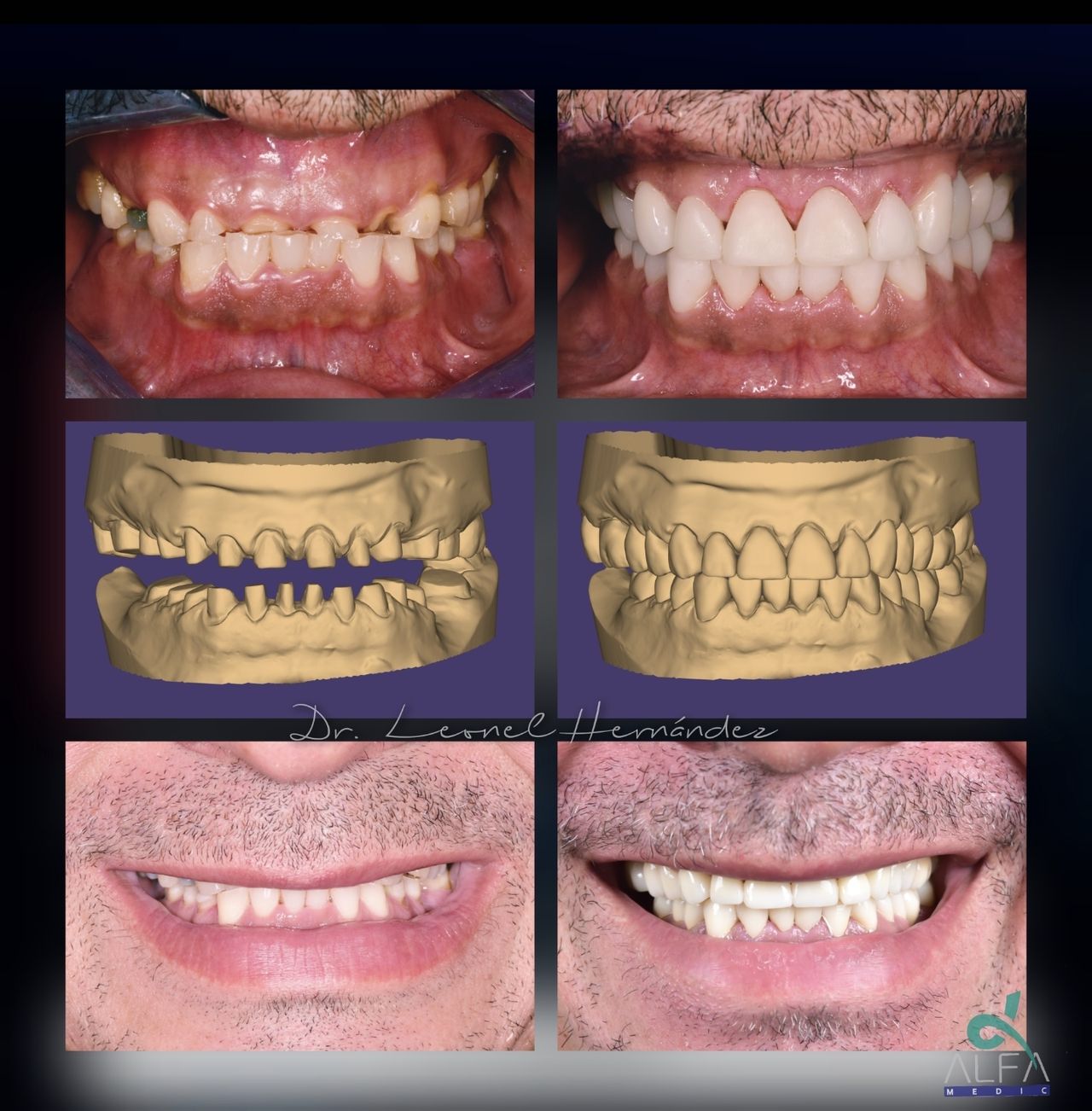 Leonel Hernández Gómez-3