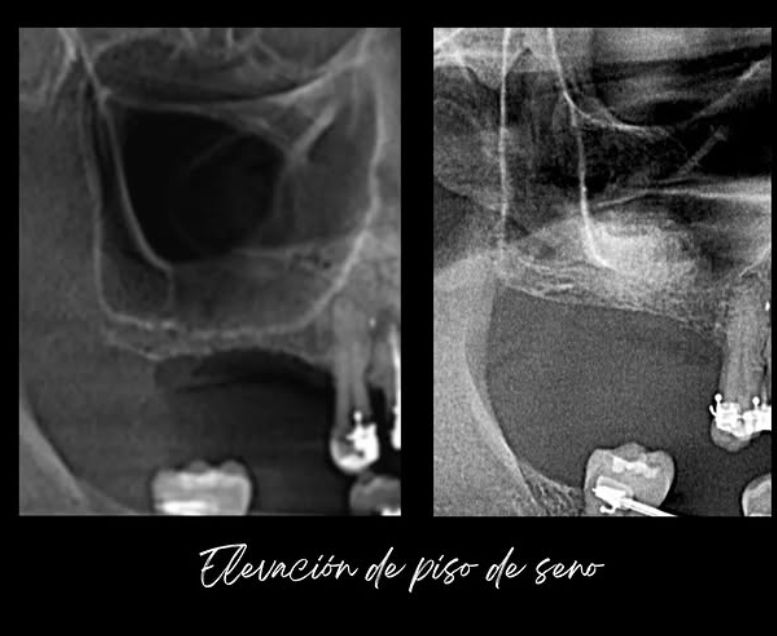 Berenice Ontiveros-4