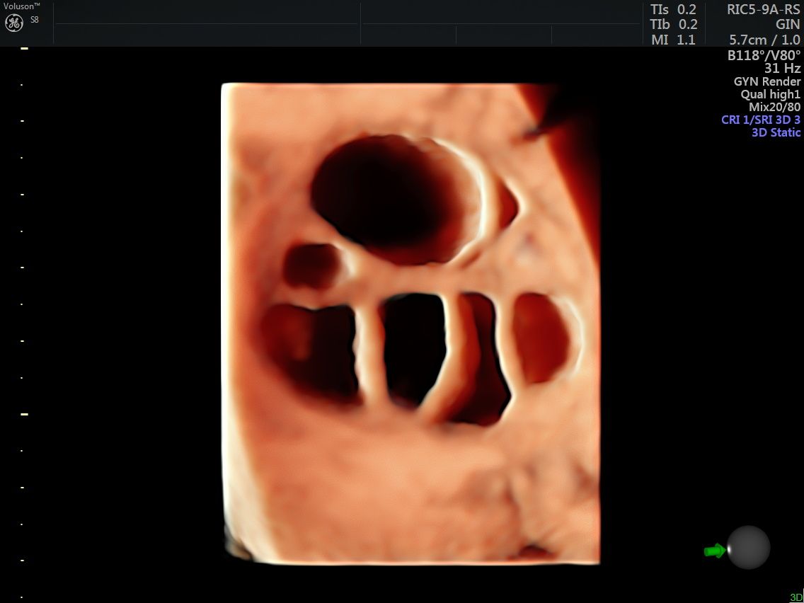 Griselda Reyes Torres-67