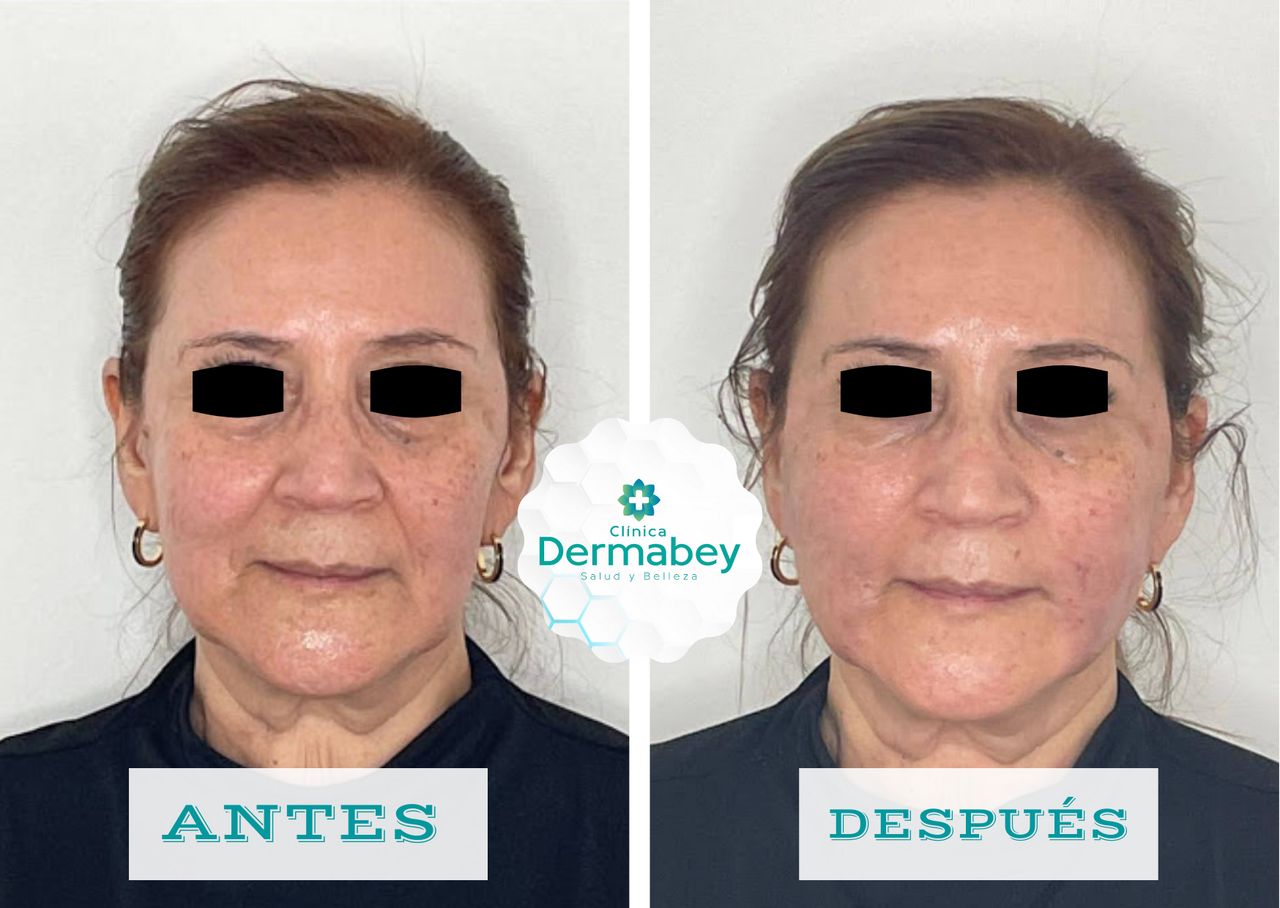 Fenicia Elena Martínez Bey-7