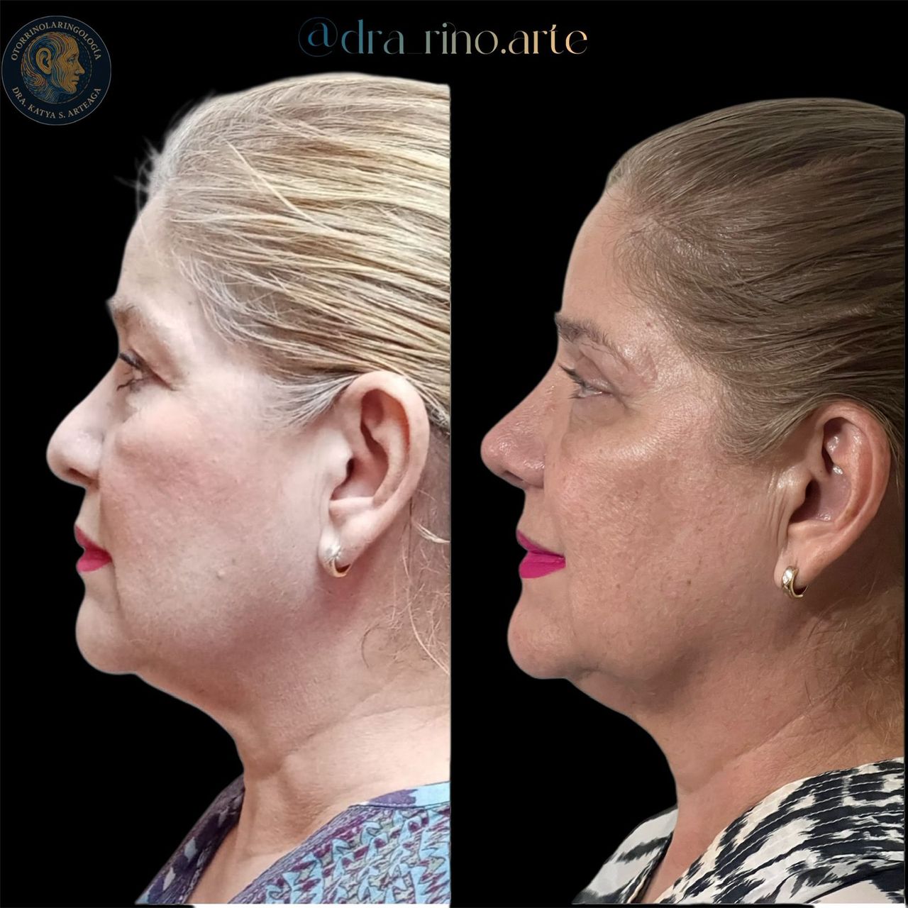 Katya Itzel Sánchez Arteaga-1