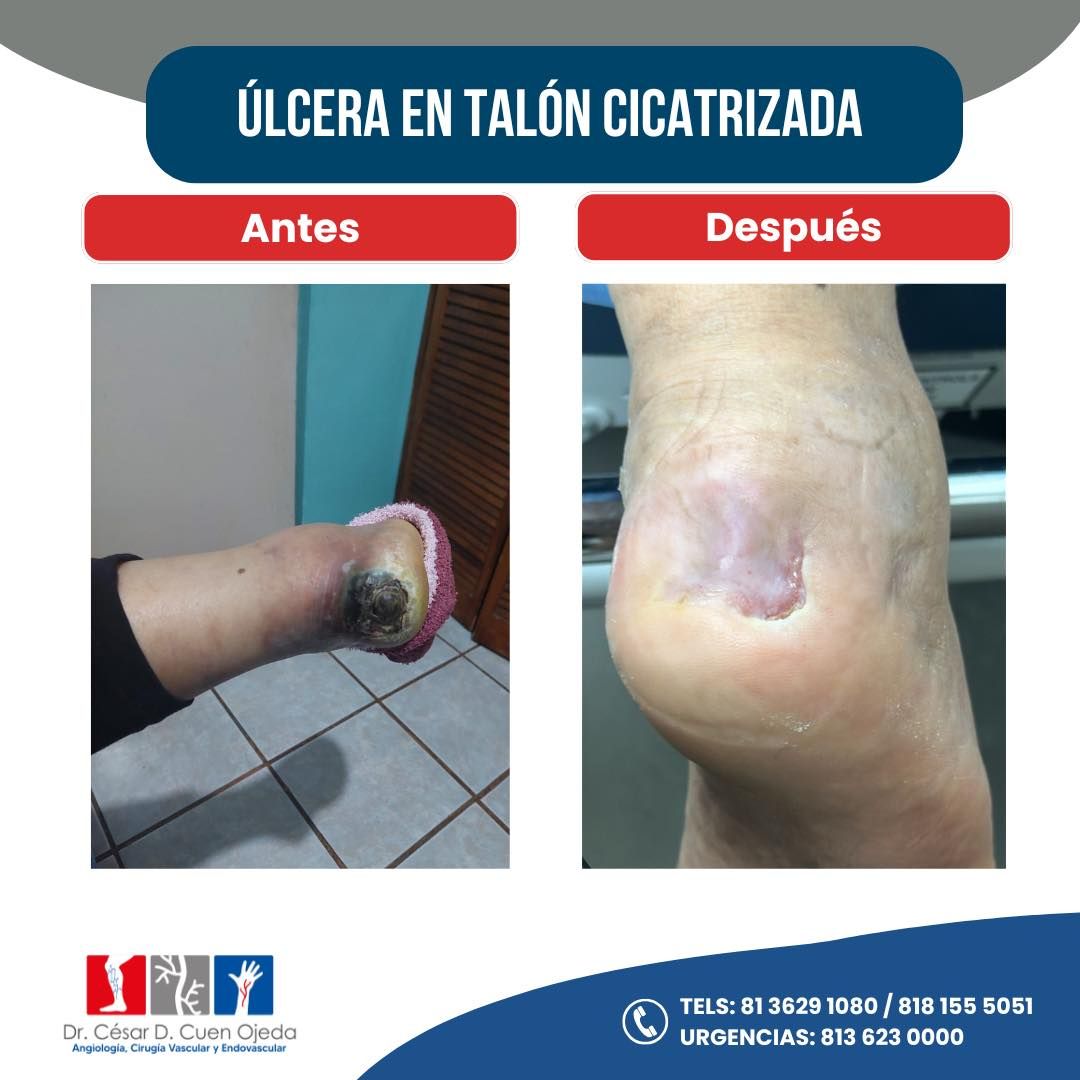 César Daniel Cuen Ojeda-4