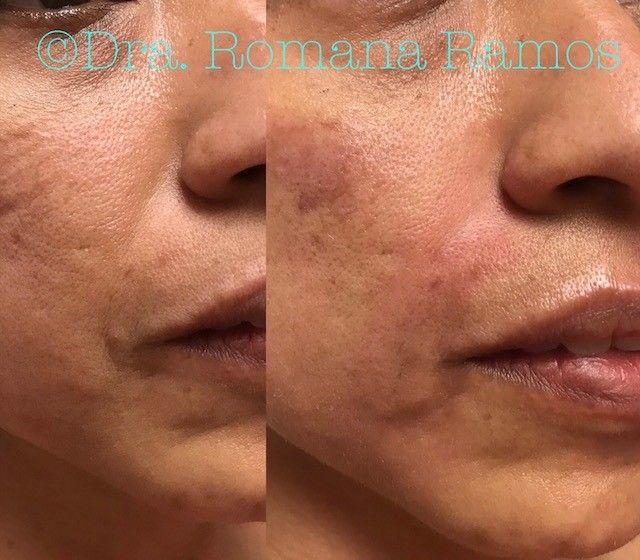 Romana Ramos Cárdenas-18