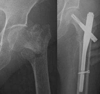 Luis Castañón Robles-25