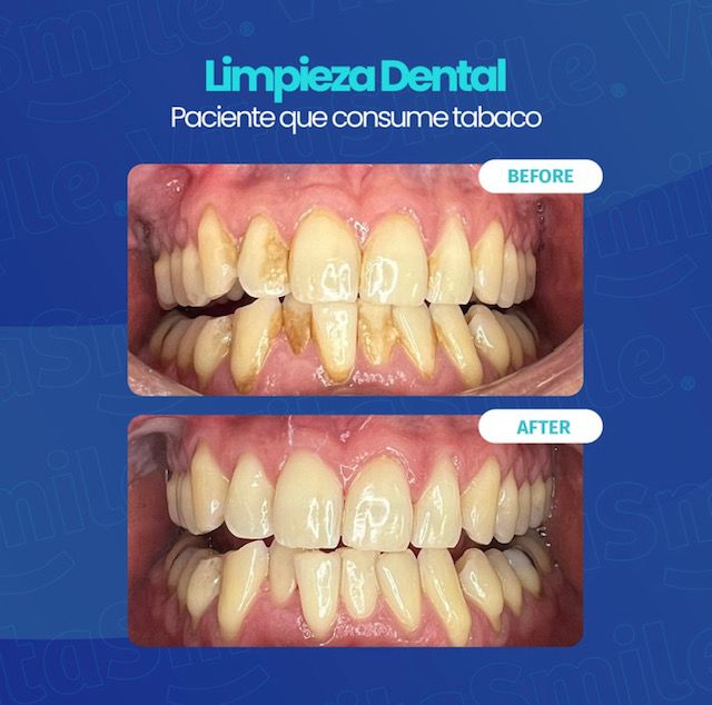 Genesis Johanna Cazares Valles-0