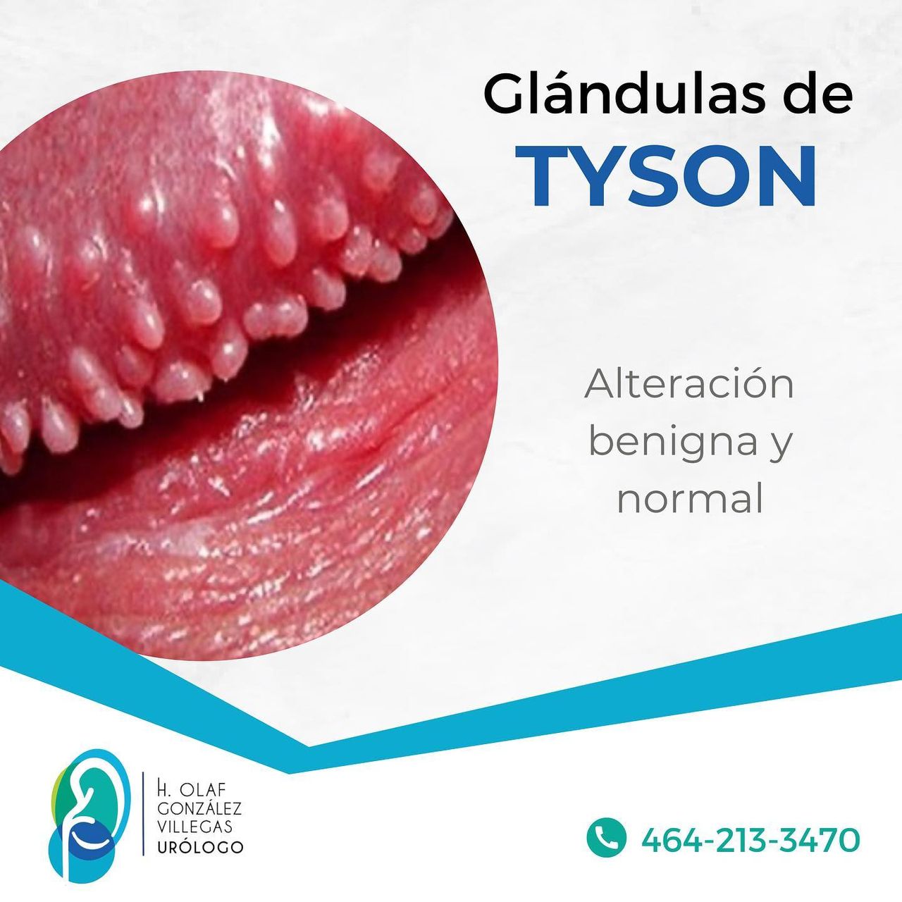 H.olaf Gonzalez Villegas-5