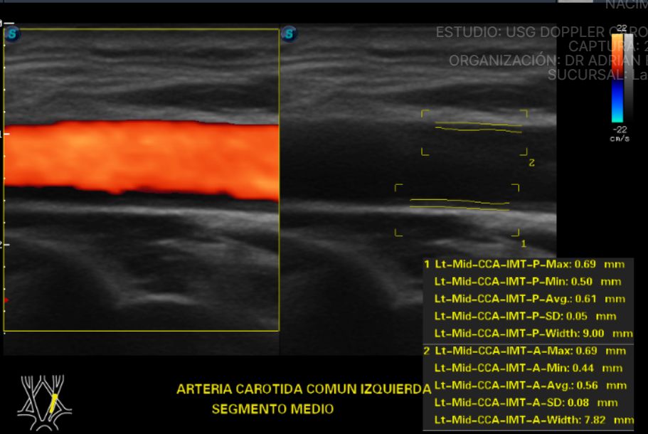 Adrian Estrada Campos-18