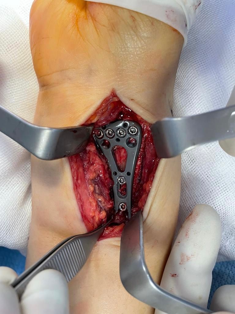 Gisela Cleto Zepeda-157