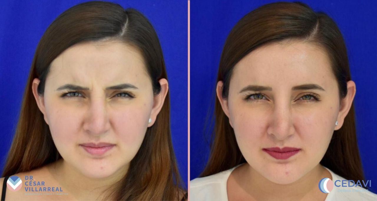 César Daniel Villarreal Villarreal-8