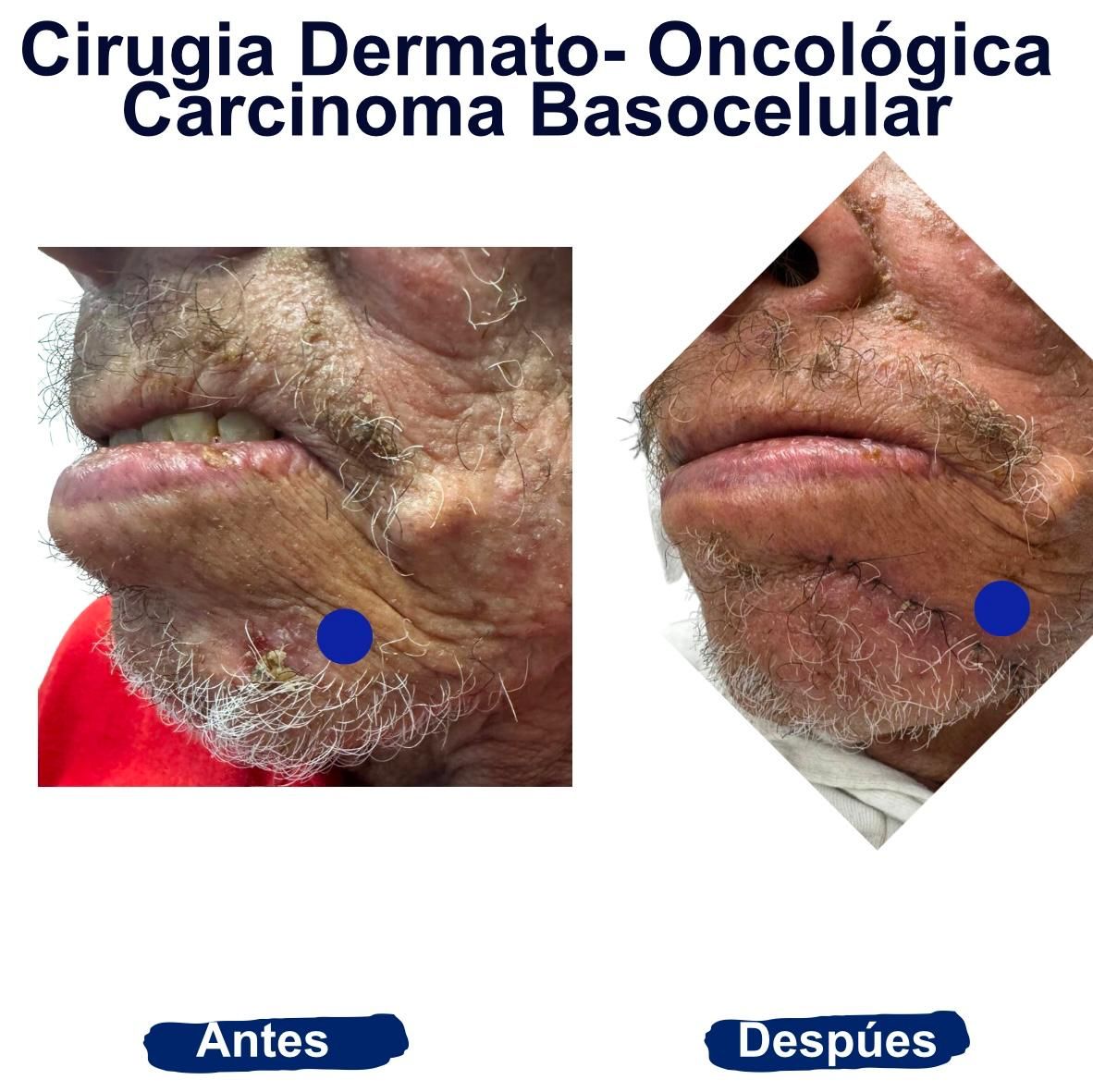 Itzel Anayn Flores Reyes-18