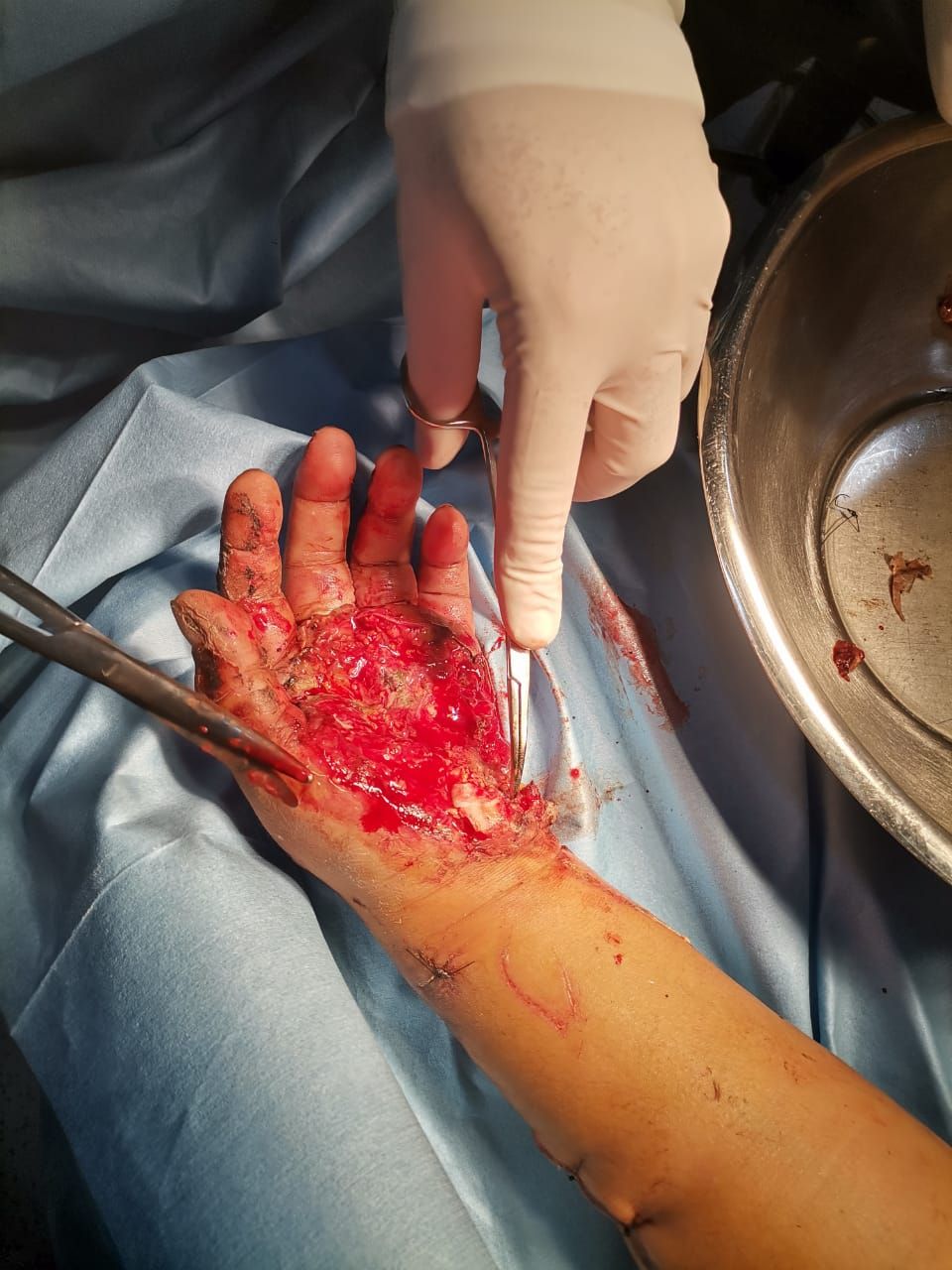 Federico Quintana De La Rosa-46