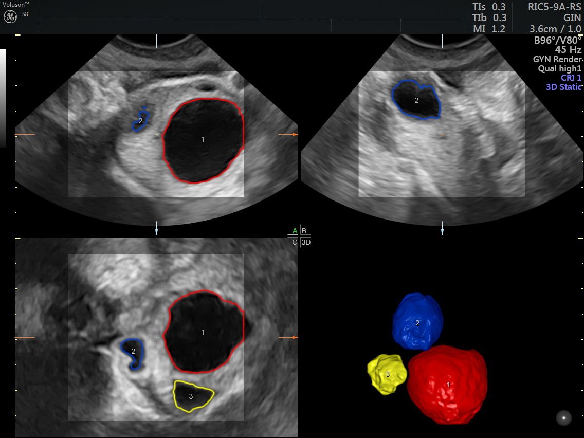 Griselda Reyes Torres-86