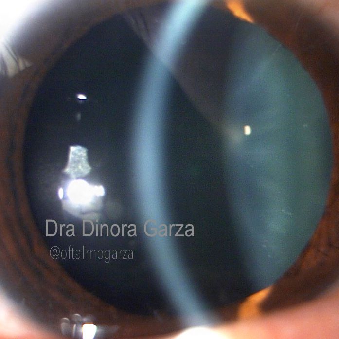 Dinora Garza Leal-16