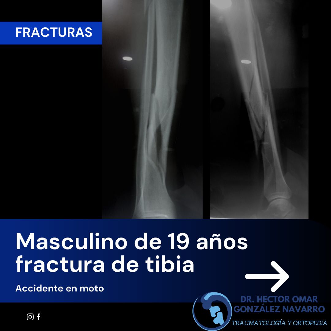 Héctor Omar González Navarro-0