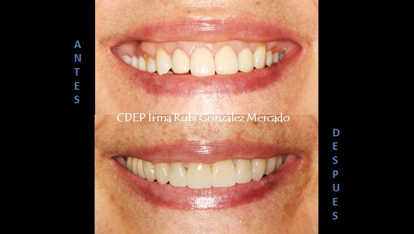 Irma Rubí González Mercado-1