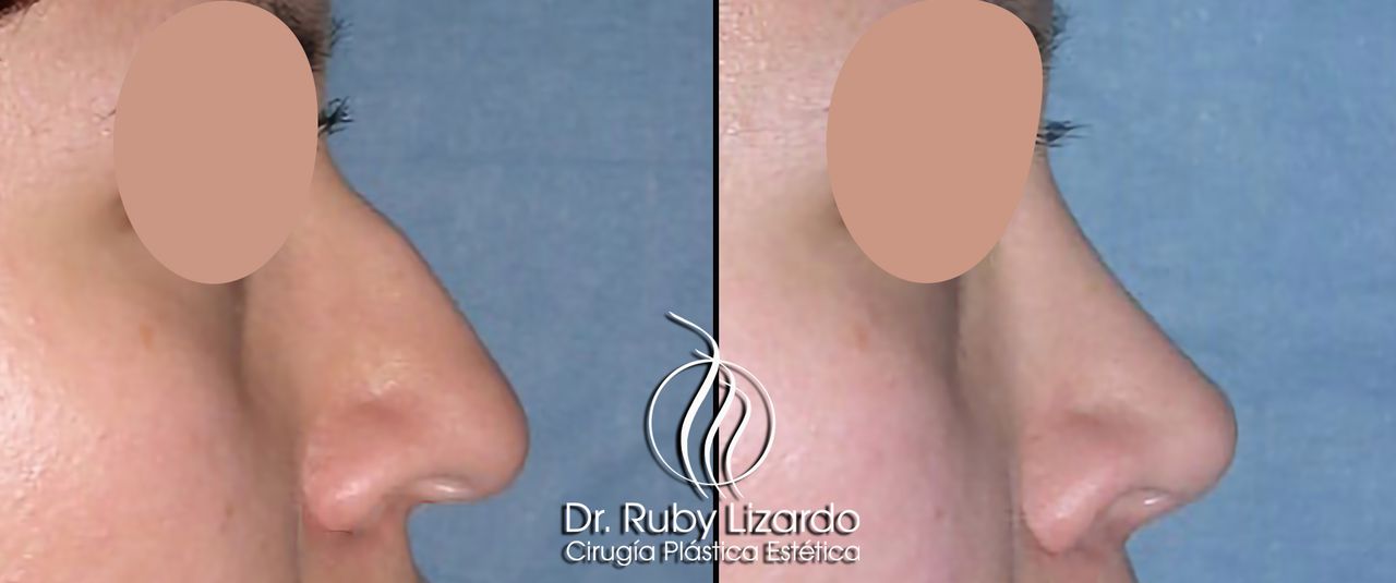 Ruby Lizardo Ramírez Robles-7