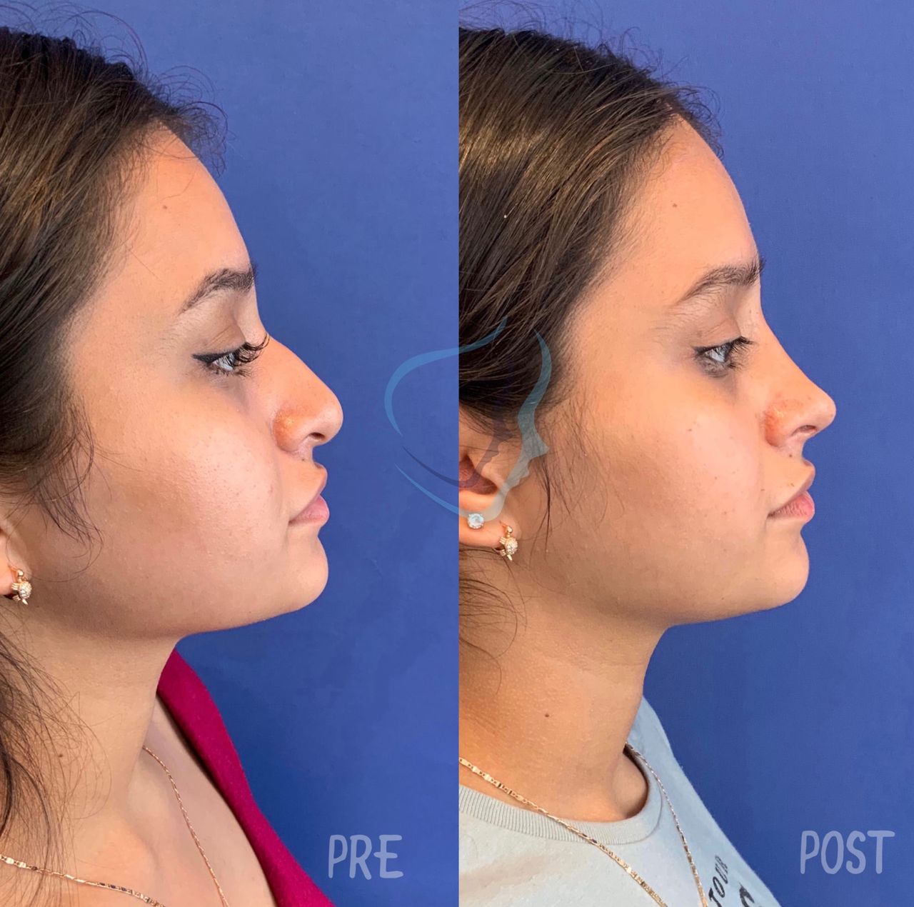 Giuseppe Tanzillo-70