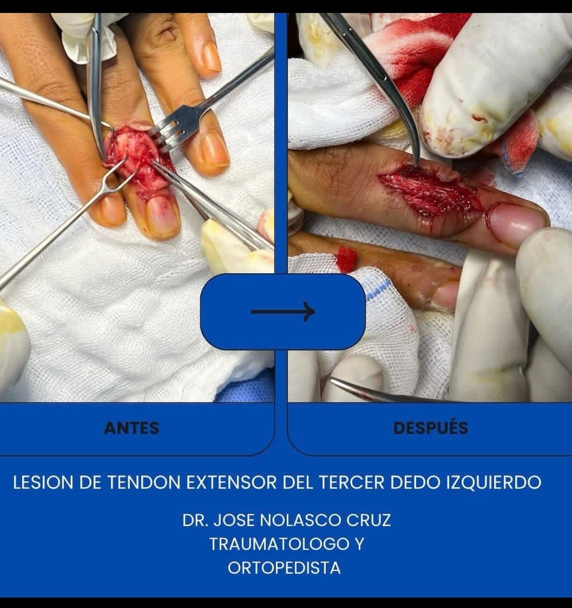 Jose Nolasco Cruz-18